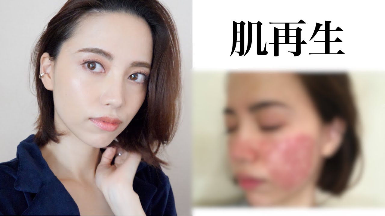 【衝撃】美容 医療、やってよかった！