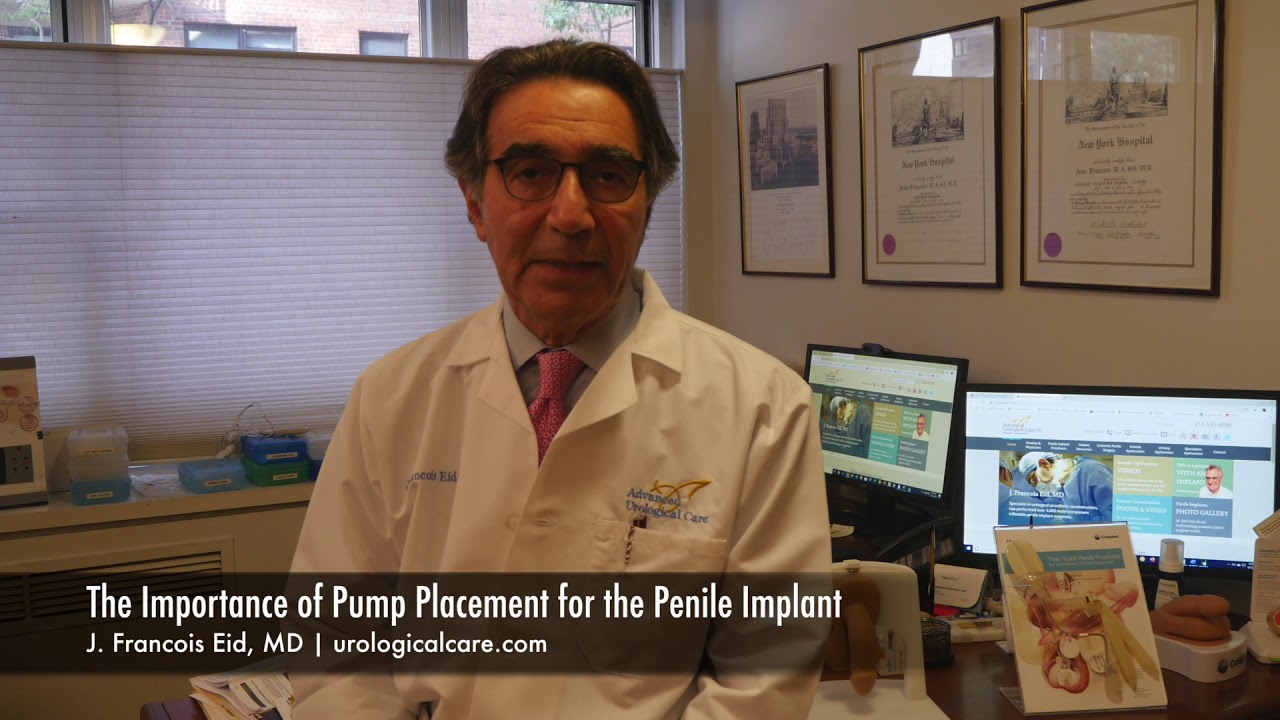 The Importance of Pump Placement for the Penile Implant