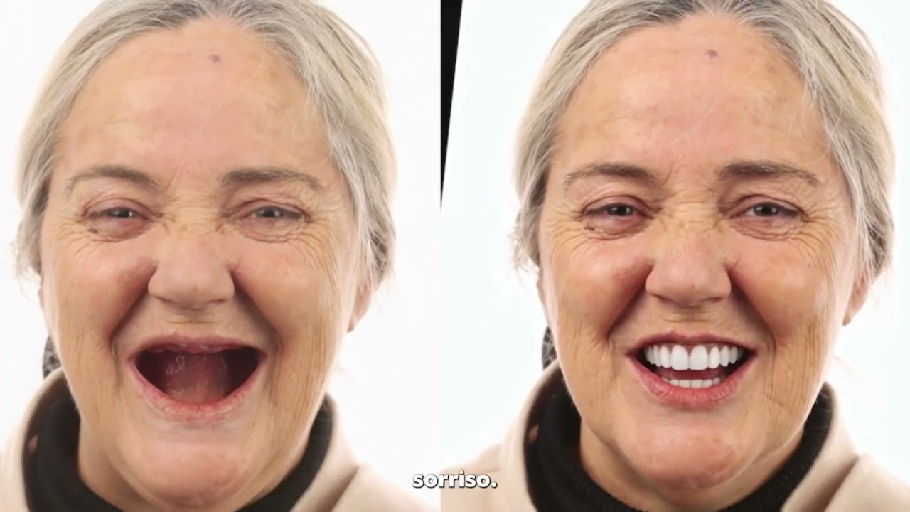 Veja o Seu Novo Sorriso Antes de Qualquer Intervenção! Test Drive do Sorriso