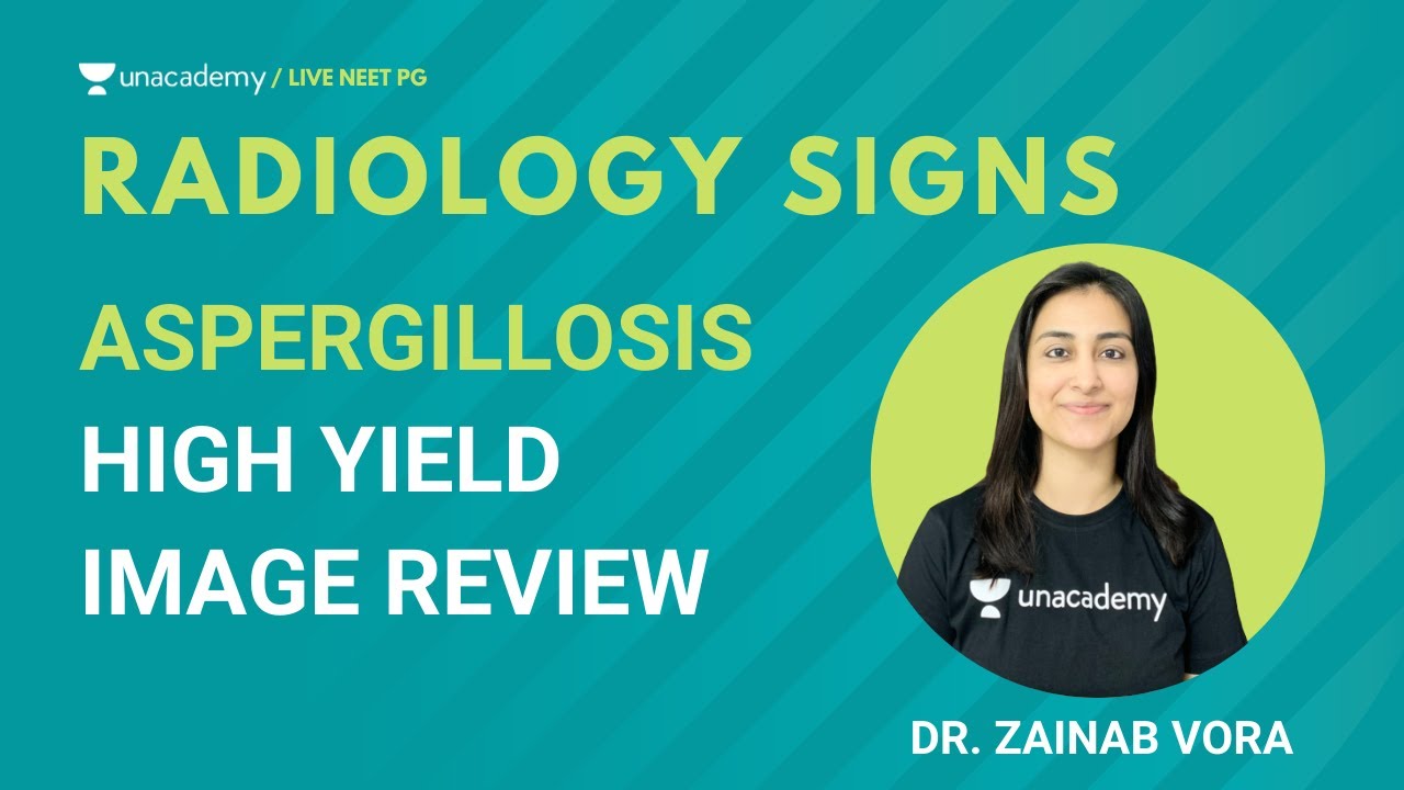 Radiology Signs | High Yield image review in radiology | Aspergillosis | Dr. Zainab Vora