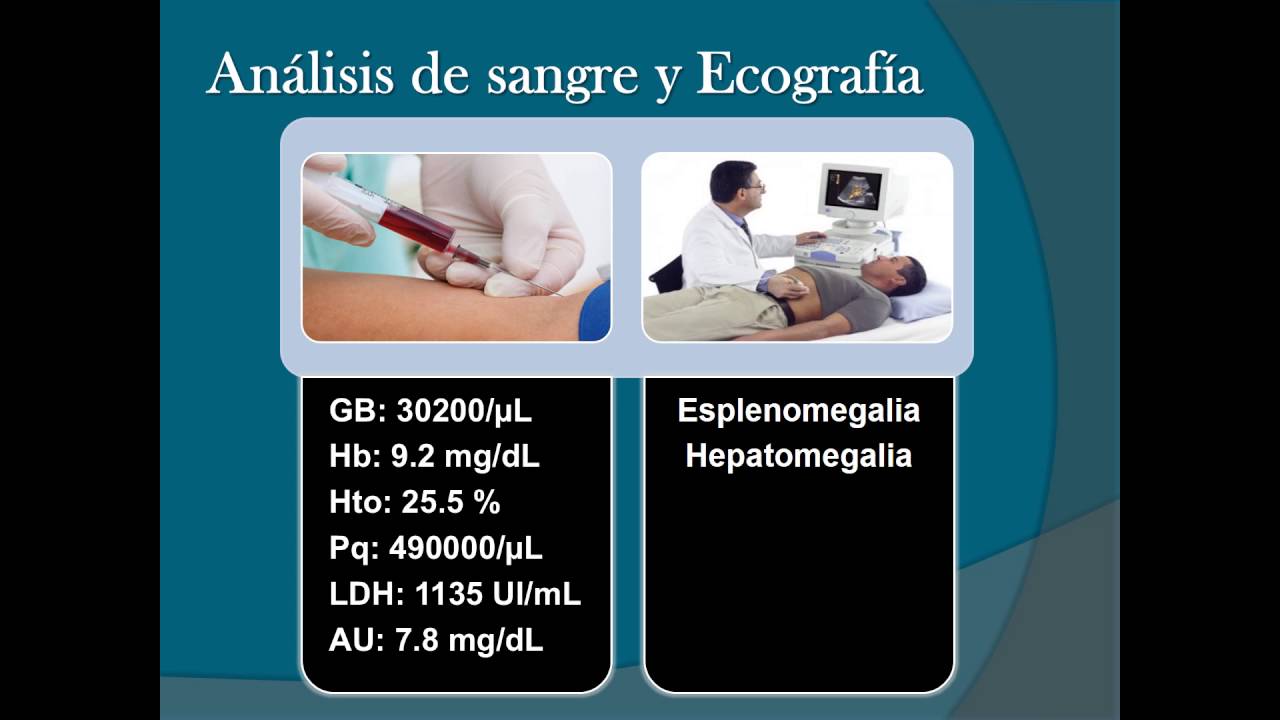 2016/05 - Policitemia Vera