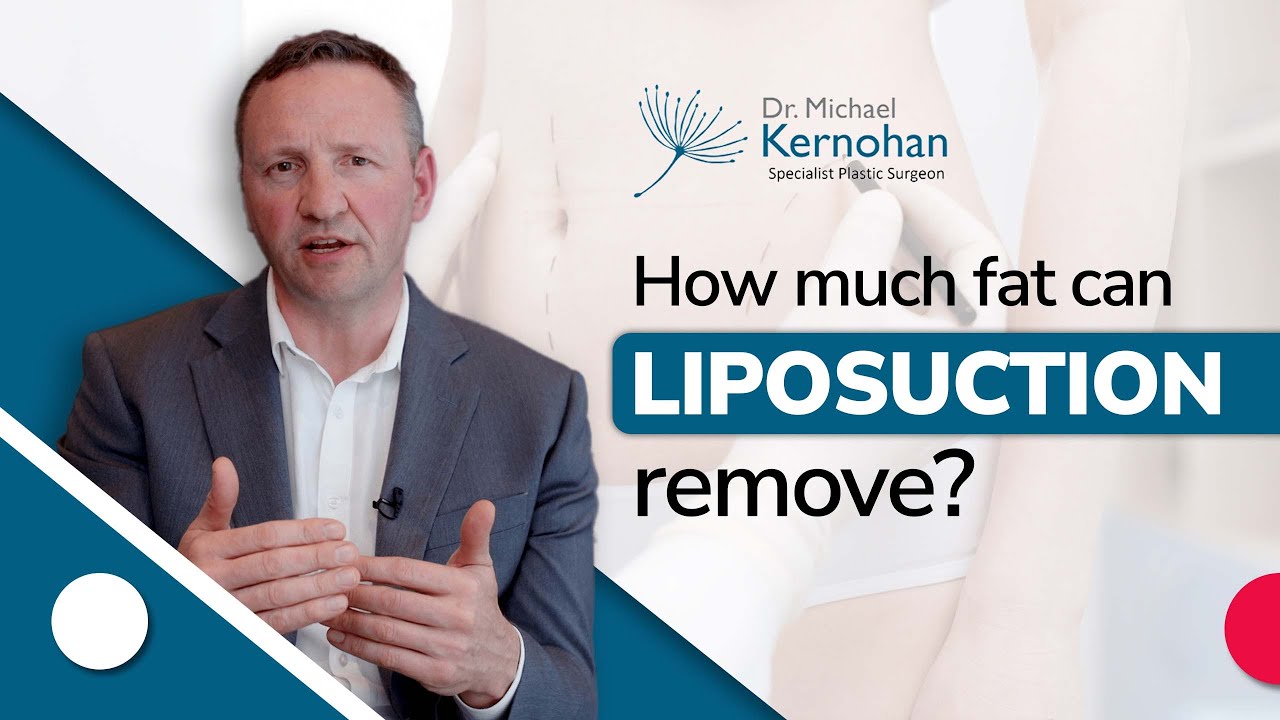 How much fat can be removed with liposuction?
