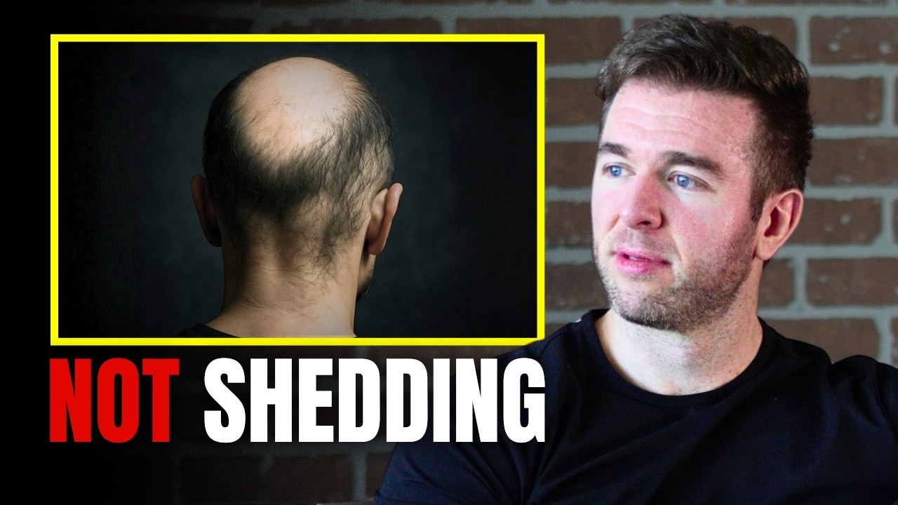 Why Most Men Go Bald (Not What You Think)
