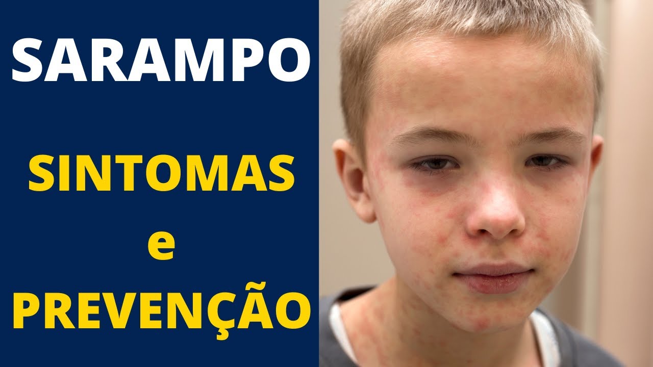 SARAMPO: O que É I Transmissão I SINTOMAS I PREVENÇÃO
