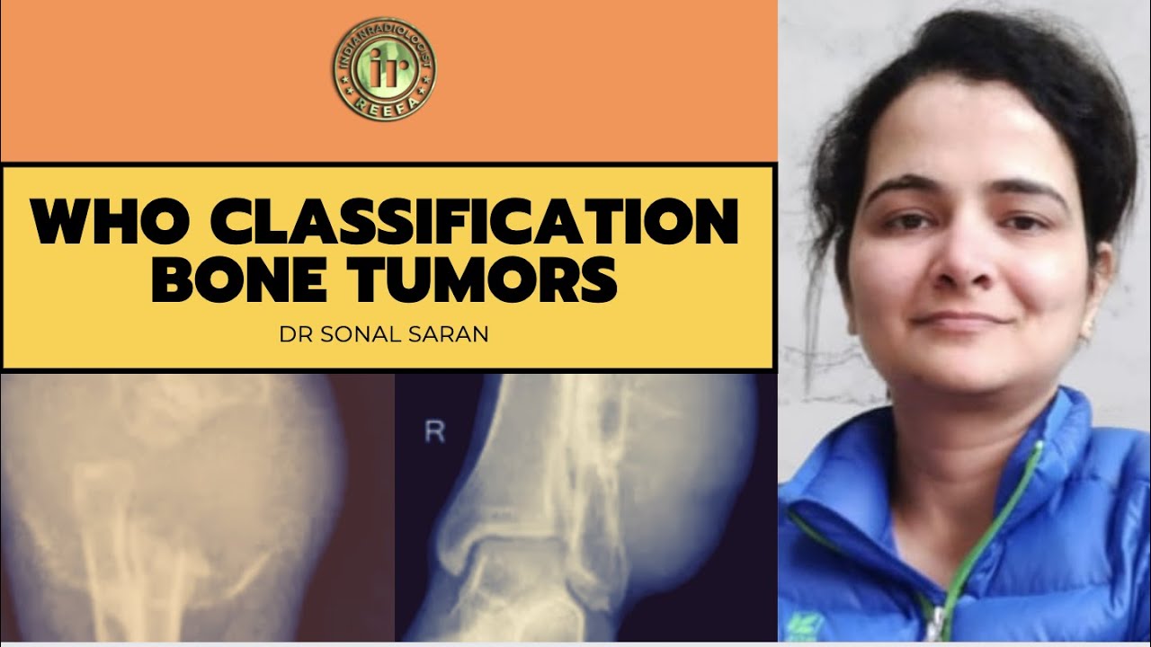WHO CLASSIFICATION OF BONE TUMORS | DR SONAL SARAN | OSTEOSARCOMA | EWINGS | ABC | GCT | FD