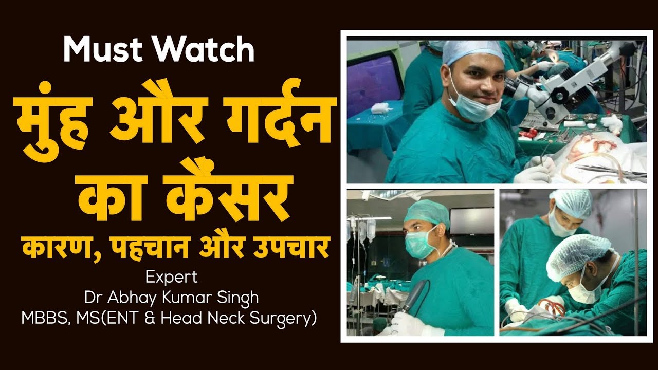 मुँह और गर्दन के कैंसर के बारे में हर वो जानकारी जो आप जानना चाहते है |Head Neck Cancer |Oral Cancer
