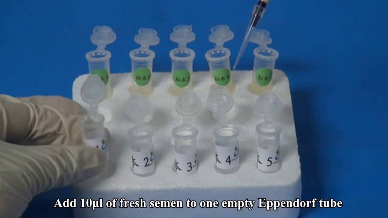 150T/Kit Sperm Vitality Test Kit Eosin Nigrosin Staining Method