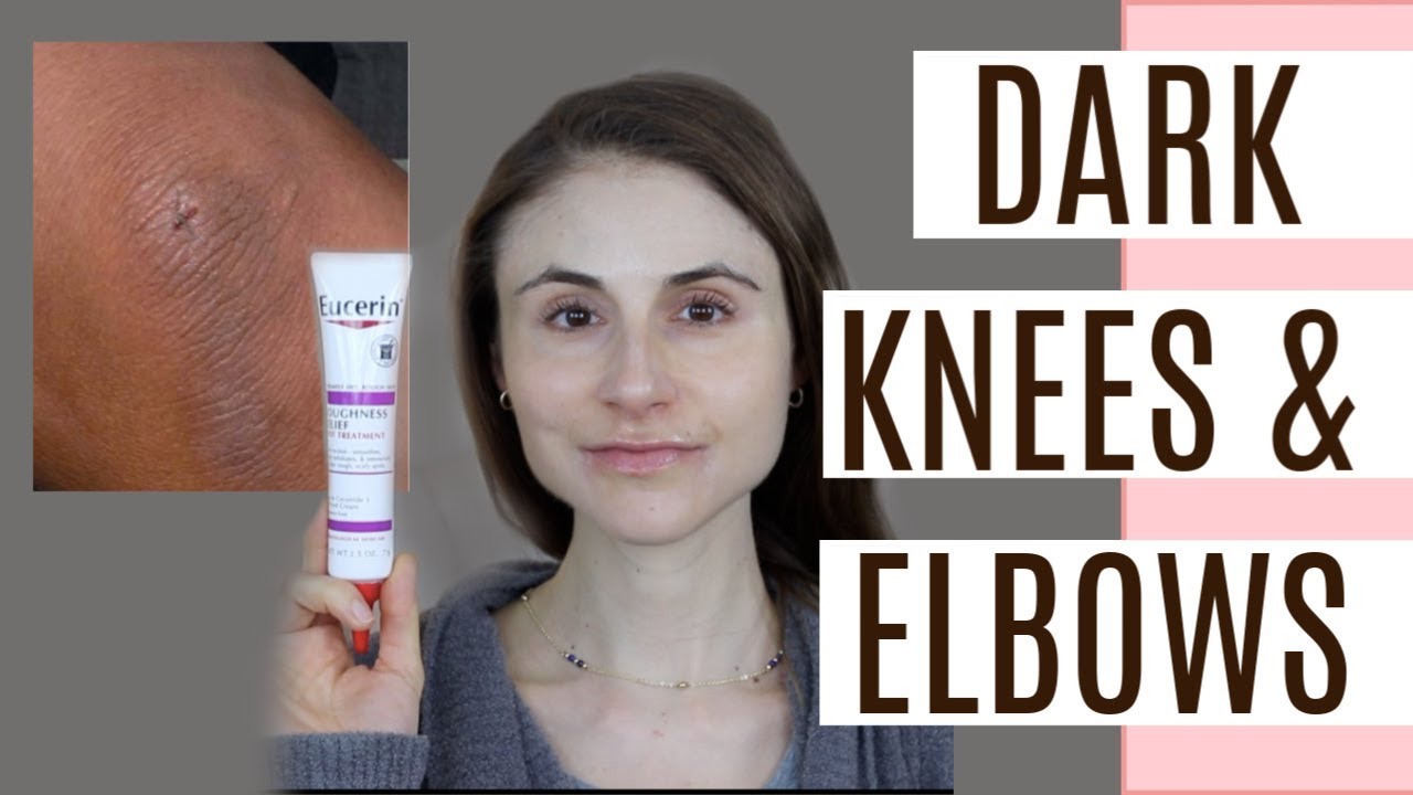 FADE DARK ELBOWS & KNEES| Q&A WITH DERMATOLOGIST DR DRAY