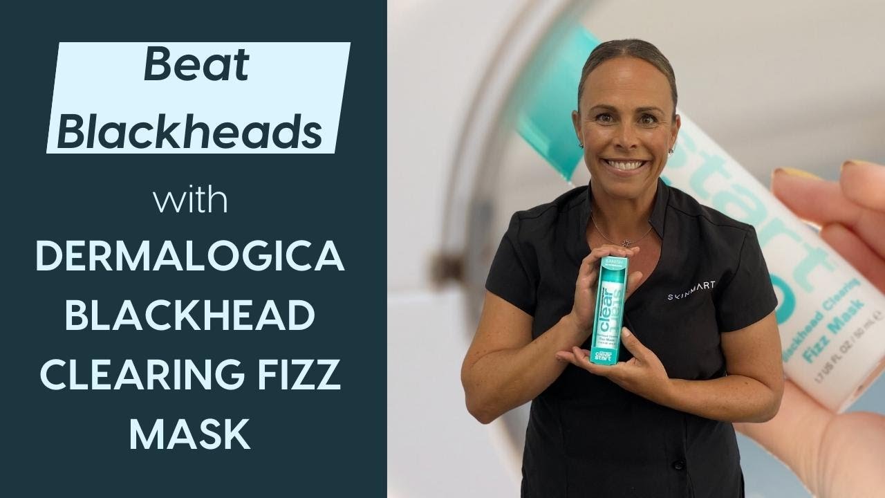 Beat Blackheads! With Dermalogica's Blackhead Clearing Fizz Mask