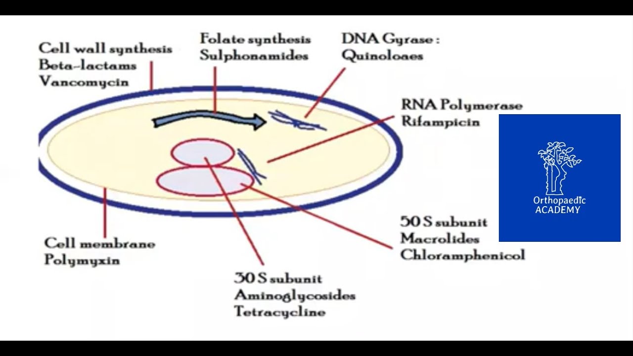 Bacteriology and Infection Prevention for Orthopaedic Postgraduate FRCS Exams | Orthopaedic Academy