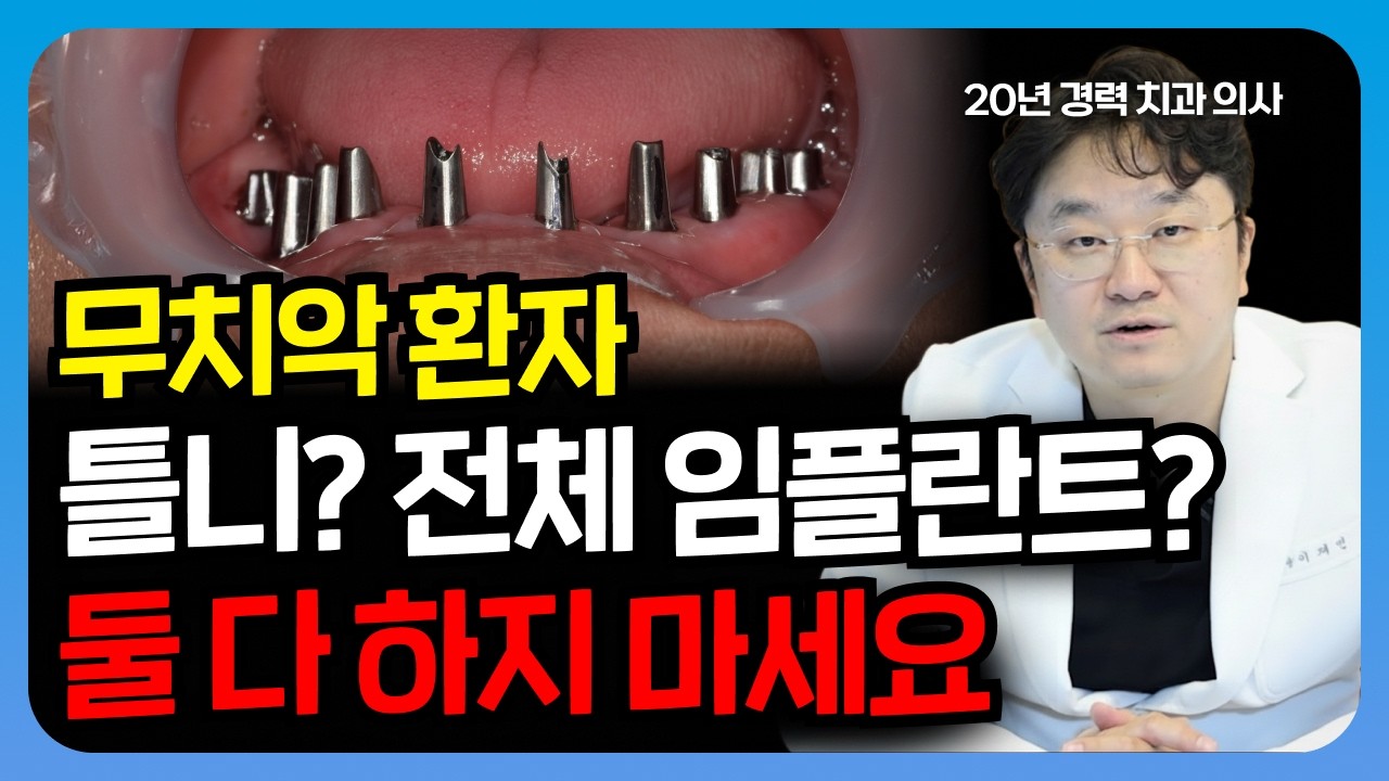 틀니 vs 전체임플란트 vs 풀아치