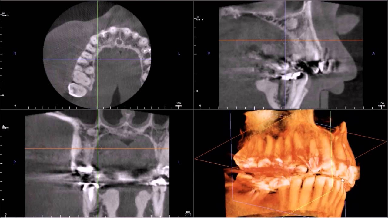 Oral Radiologists Cone Beam CT Interpretation 1