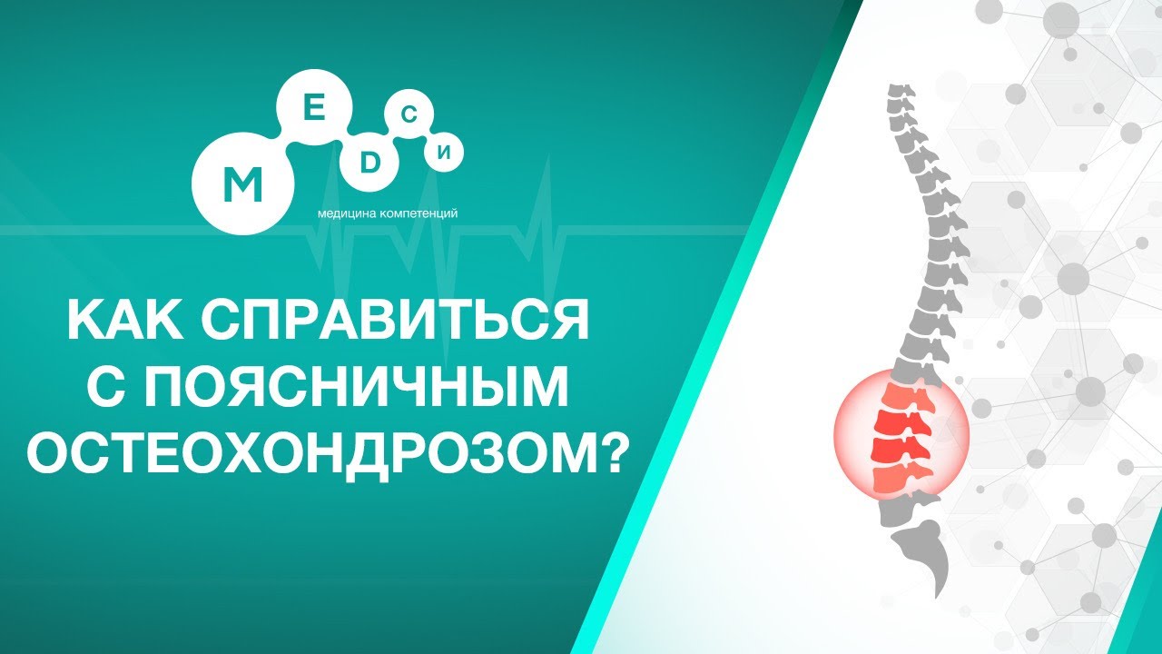 Остеохондроз поясничного отдела. Симптомы, причины, диагностика и лечение остеохондроза