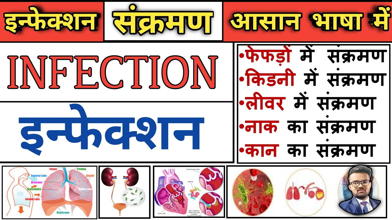 Infection | Classification of Infection | Hospital Acquired Infection | noshocomial infection