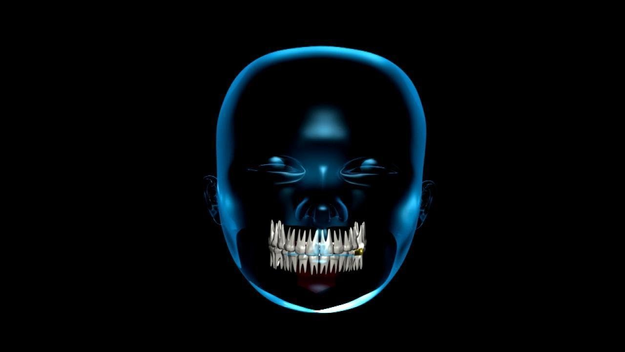 Tips to Stop Teeth Grinding
