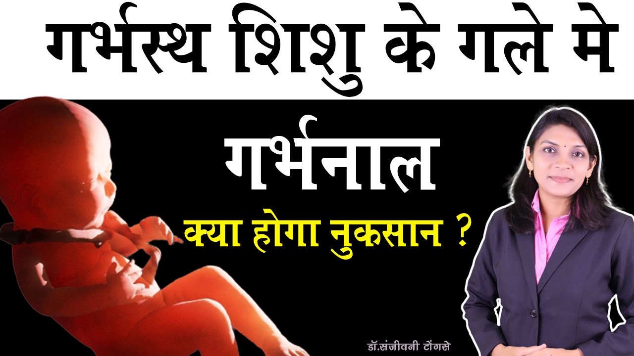 गर्भस्थ शिशु के गले में गर्भनाल क्या होंगा नुकसान ? I What is Cord arround Neck