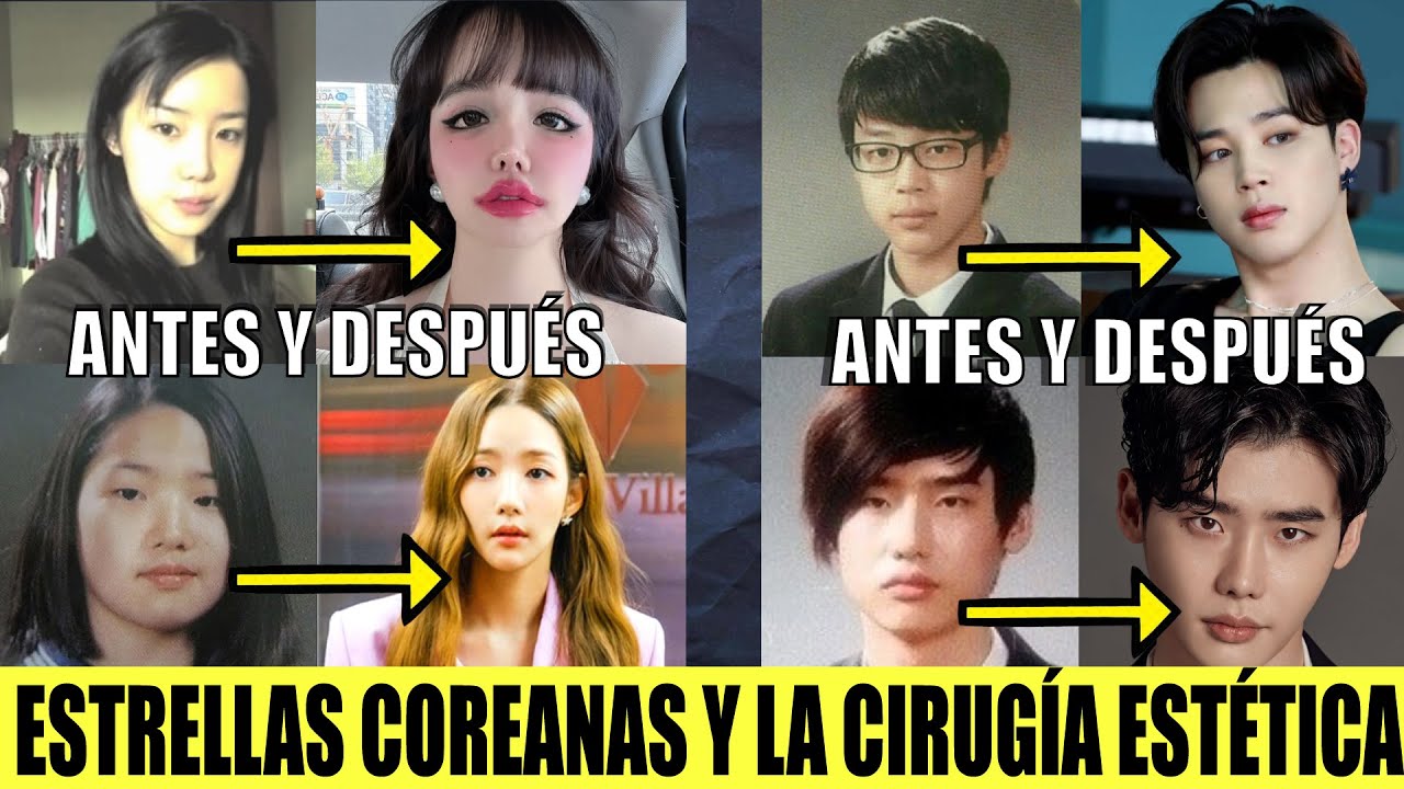 CIRUGÍA PLÁSTICA EN LOS ÍDOLS Y ACTORES COREANOS ¿ROSTROS PERFECTOS O BISTURÍ MÁGICO? #kpop  #kdrama