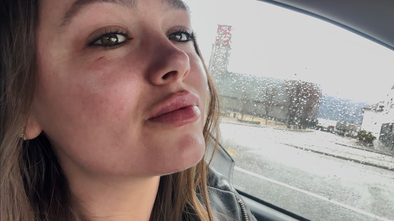 VLOG.НОРВЕГИЯ🇳🇴 УВЕЛИЧИЛА ГУБЫ 👄 
