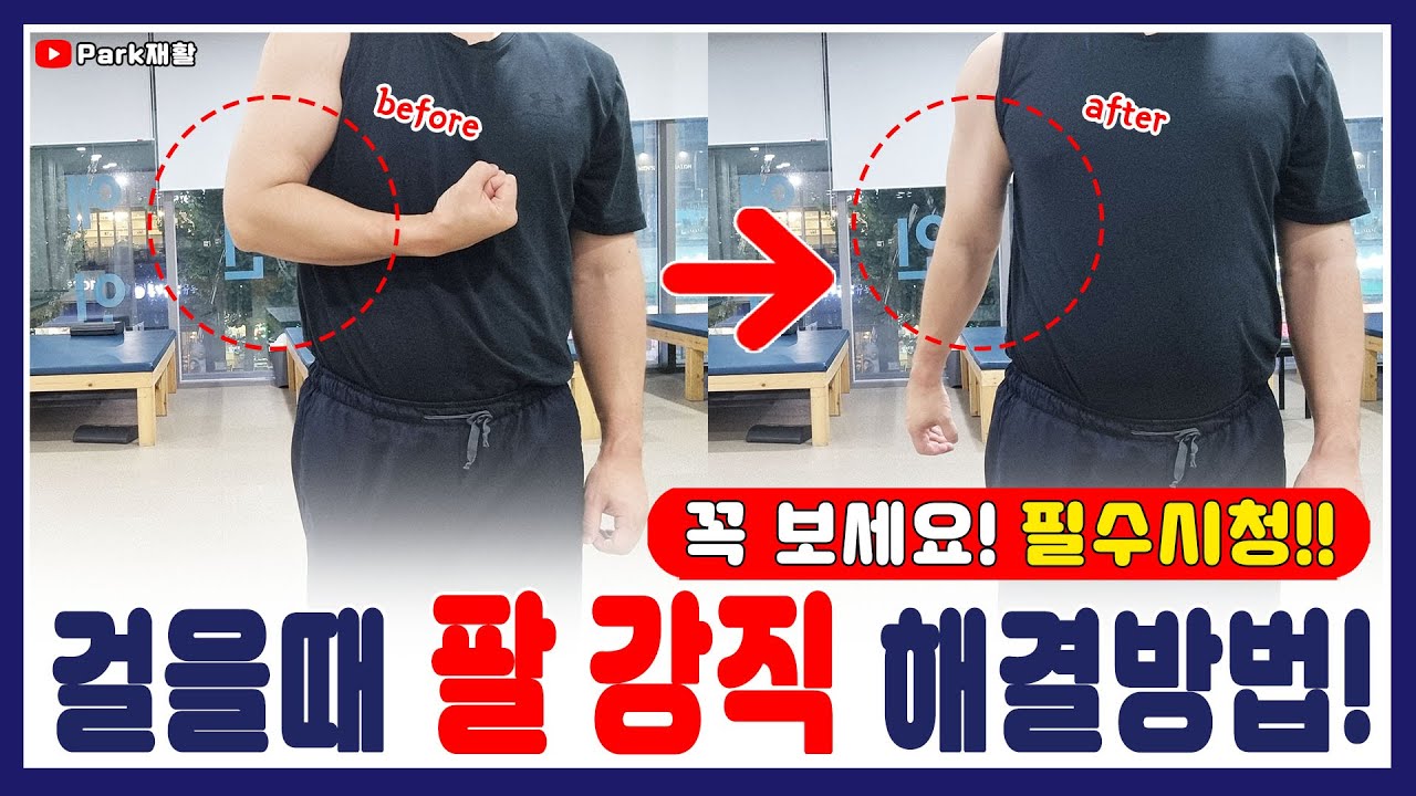 걸을때 팔 강직 해결방법[뇌졸중 뇌경색 뇌출혈 편마비] 셀프/보호자 재활운동방법! Stroke spasticity rehabilitation