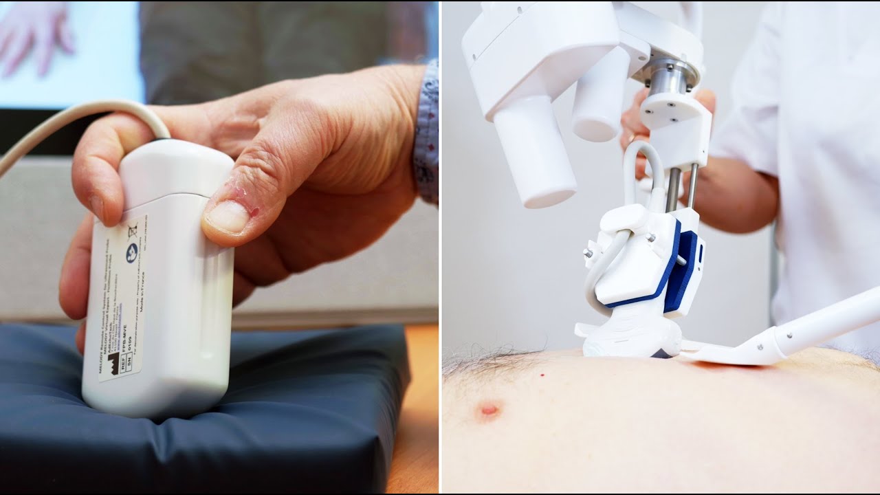 Remote Tele-operated Ultrasound - Introducing AdEchoTech's MELODY Solution