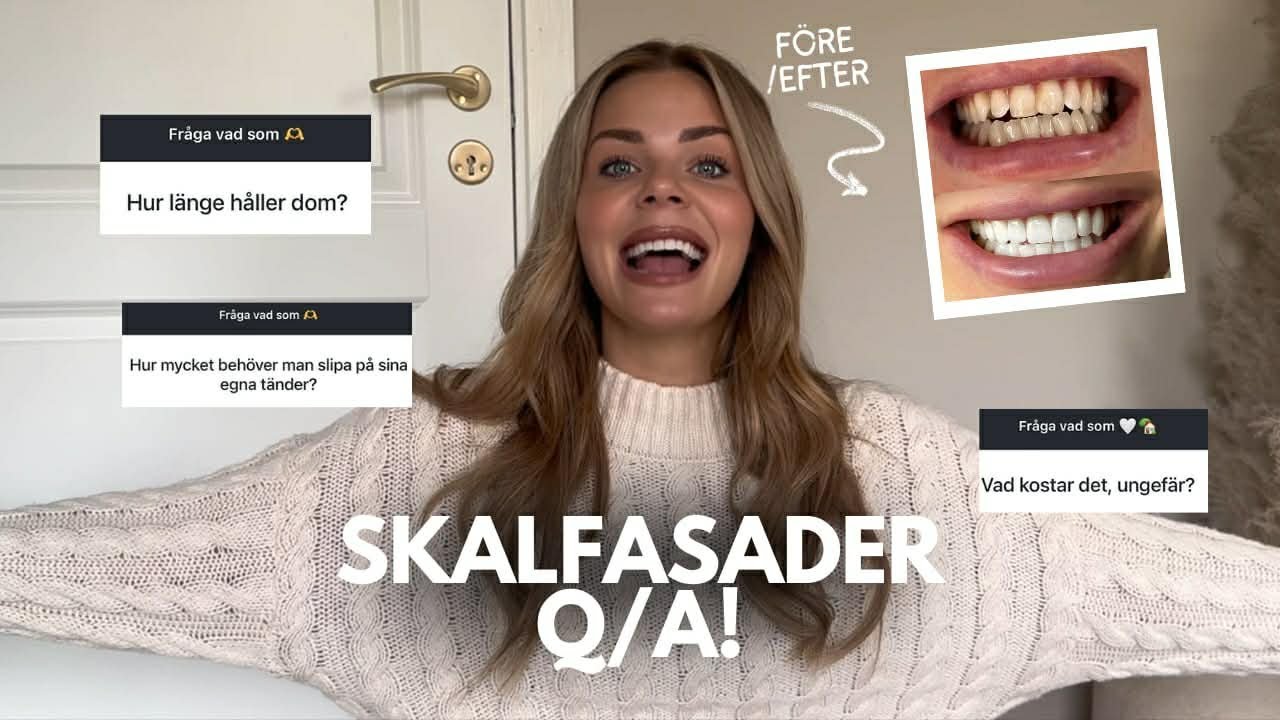 Skalfasader Q/A
