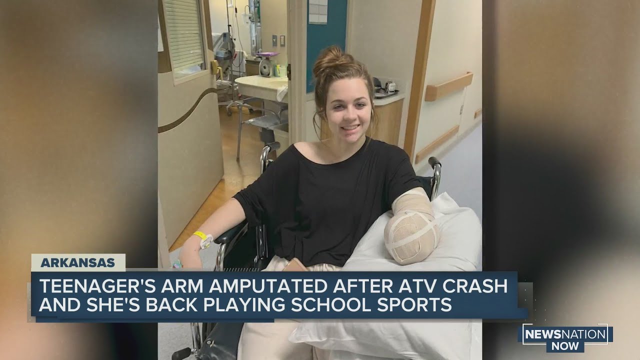 Teen returns to sports after losing arm in ATV crash