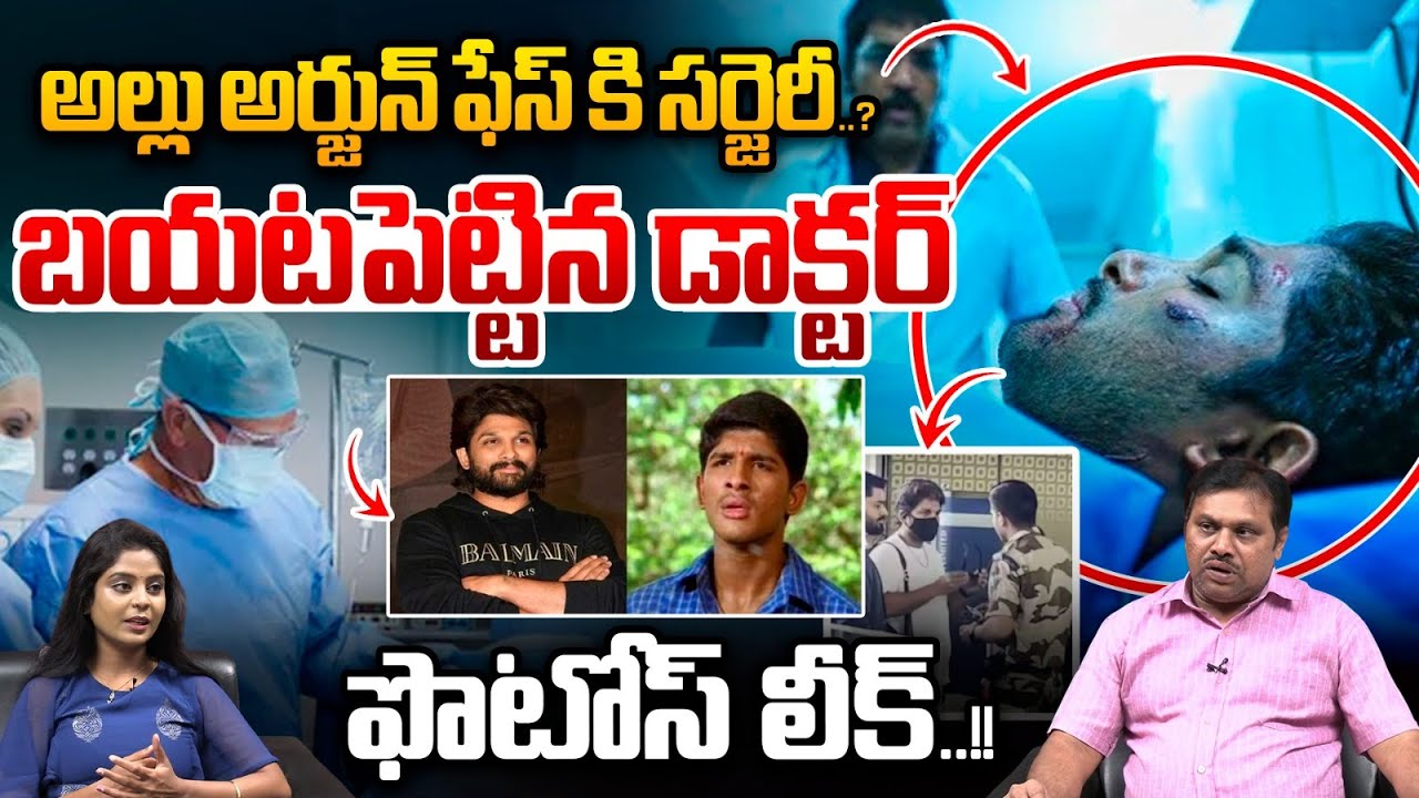 Allu Arjun Surgery : అల్లు అర్జున్ ఫేస్ కి సర్జెరీ..? బయటపెట్టిన డాక్టర్ | Wild Wolf Vijayawada
