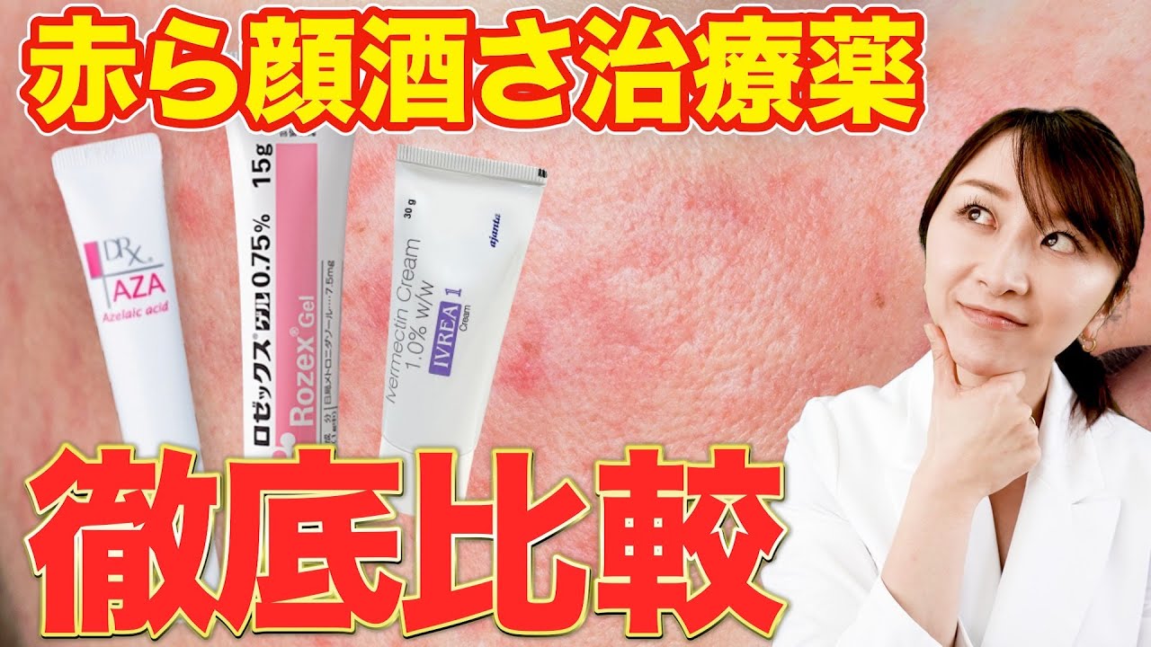 【徹底比較】赤ら顔「酒さ」の塗り薬それぞれ効果と副作用とは