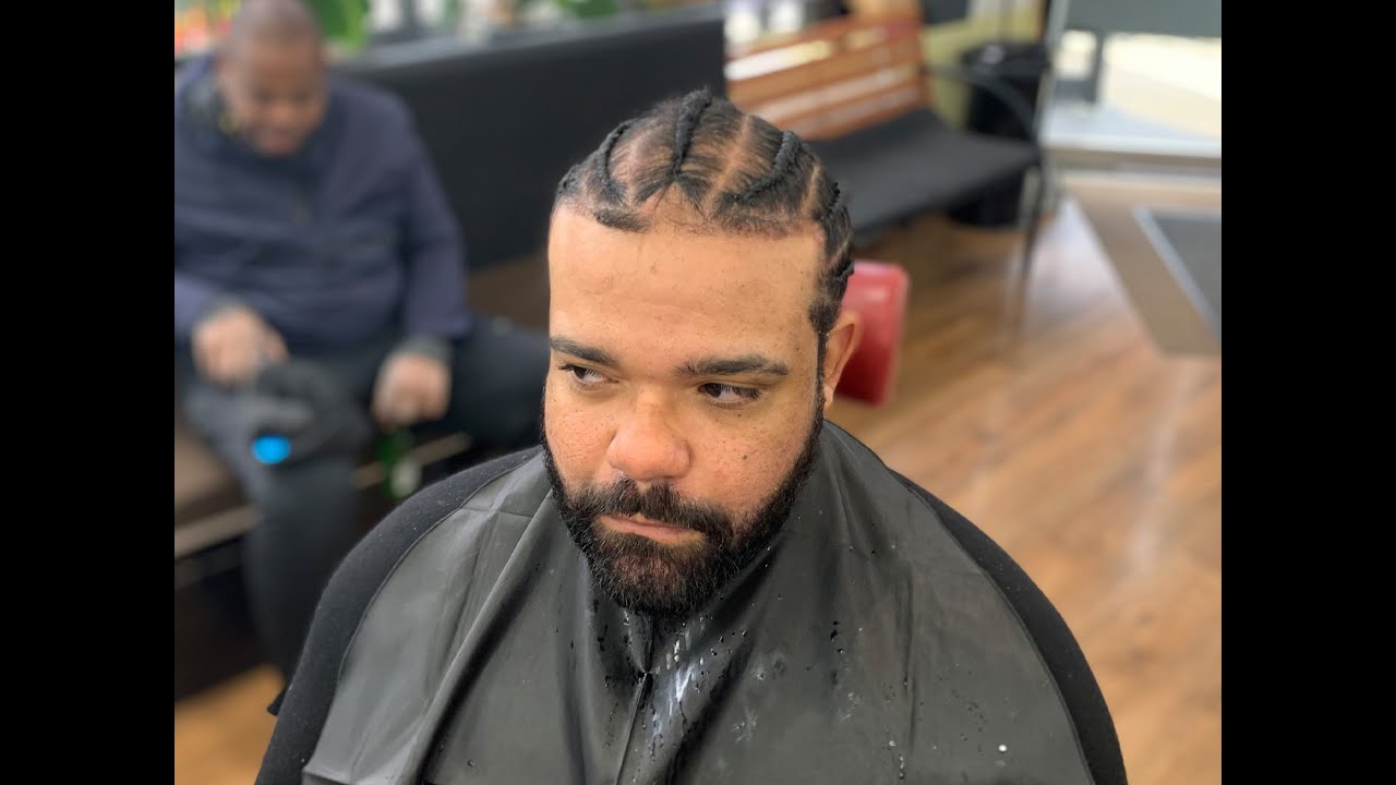 HOW TO BRAID OVER BALD PATCH + EXTREME HAIR REGROWTH