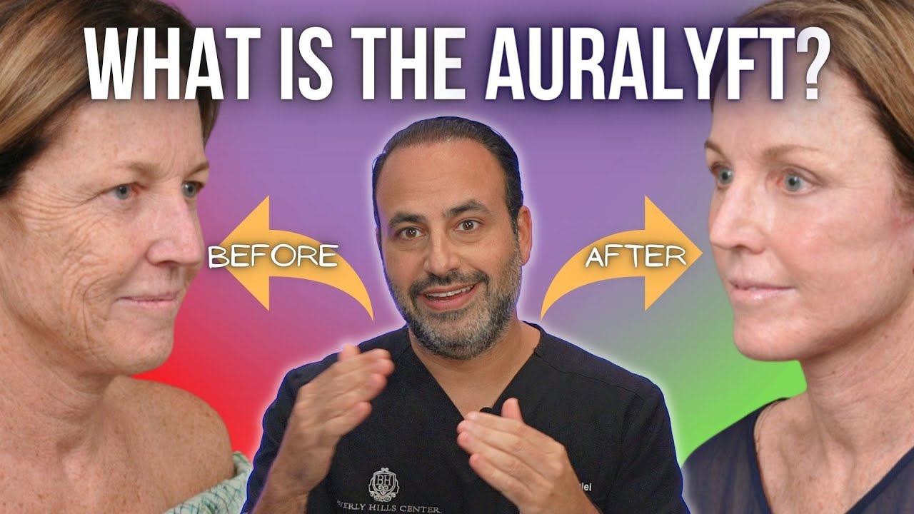 My Face Lifting Technique Explained What is the AuraLyft | Dr. Ben Talei | Beverly Hills CA