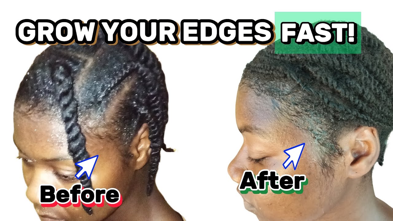 How to Regrow Your Edges FAST: What Actually Works + Science Behind It”