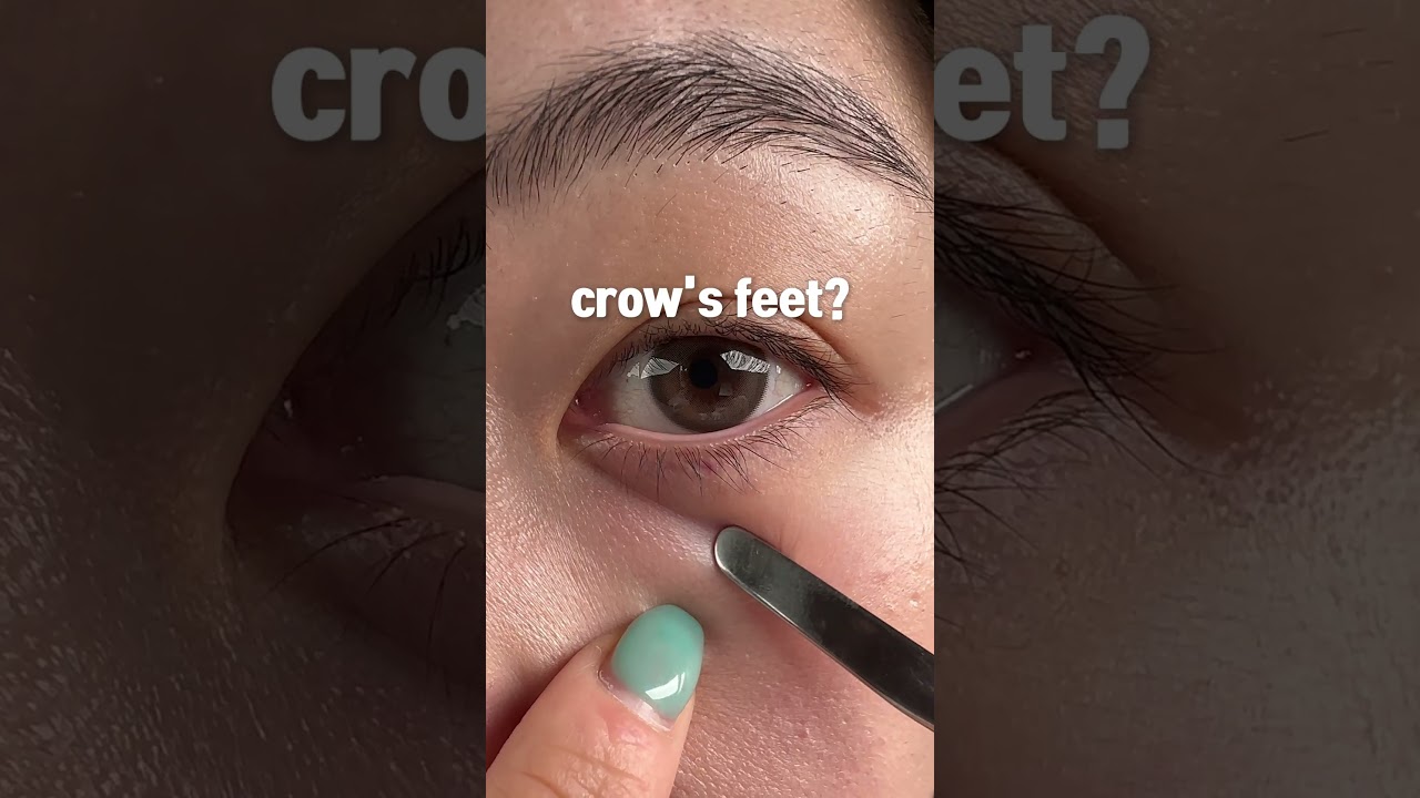 Какая у вас проблема с кожей? 