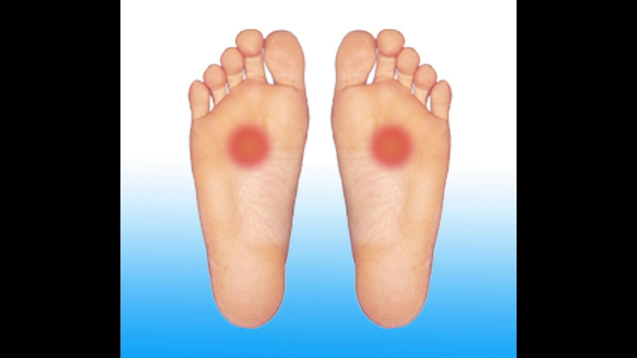 La metatarsalgia: Diagnosi e cura