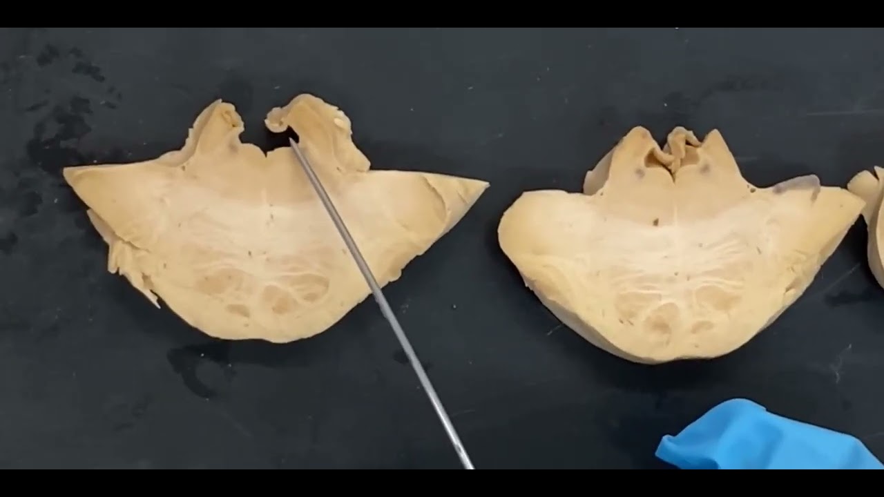 Tronco encefálico anatomía interna 2024 VS