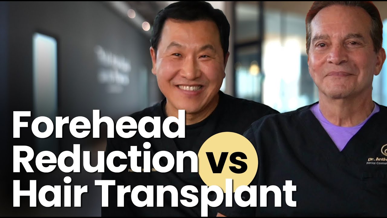 Forehead Reduction vs. Hair Transplantation: Which Is Right for You?