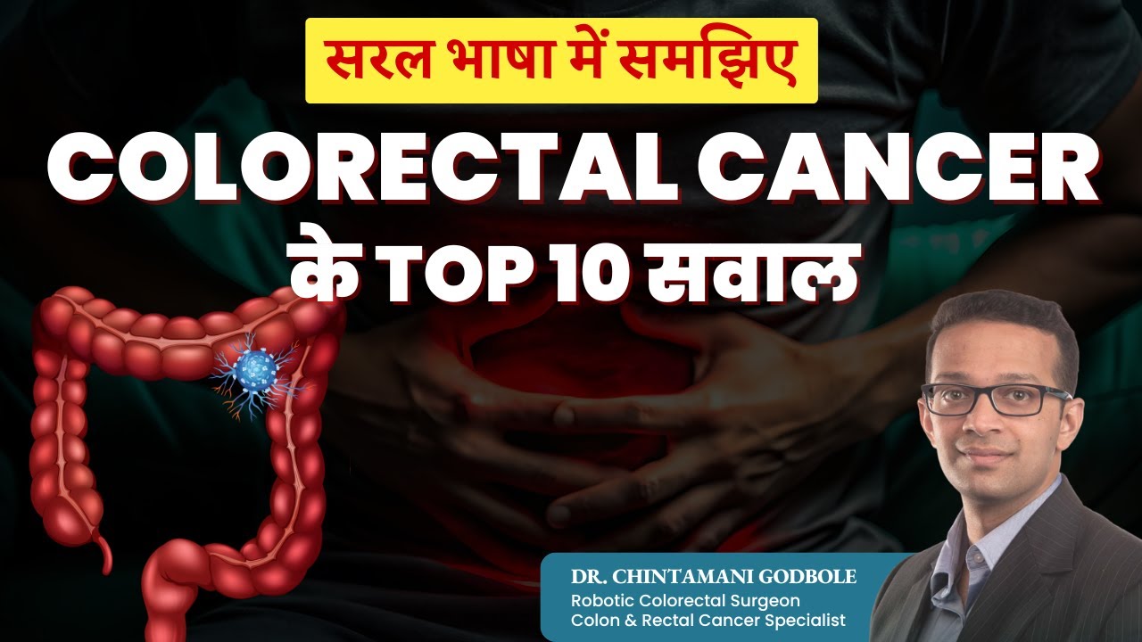 Understanding Colorectal Cancer: Answers to the 10 Most Asked Questions - Dr. Chintamani Godbole
