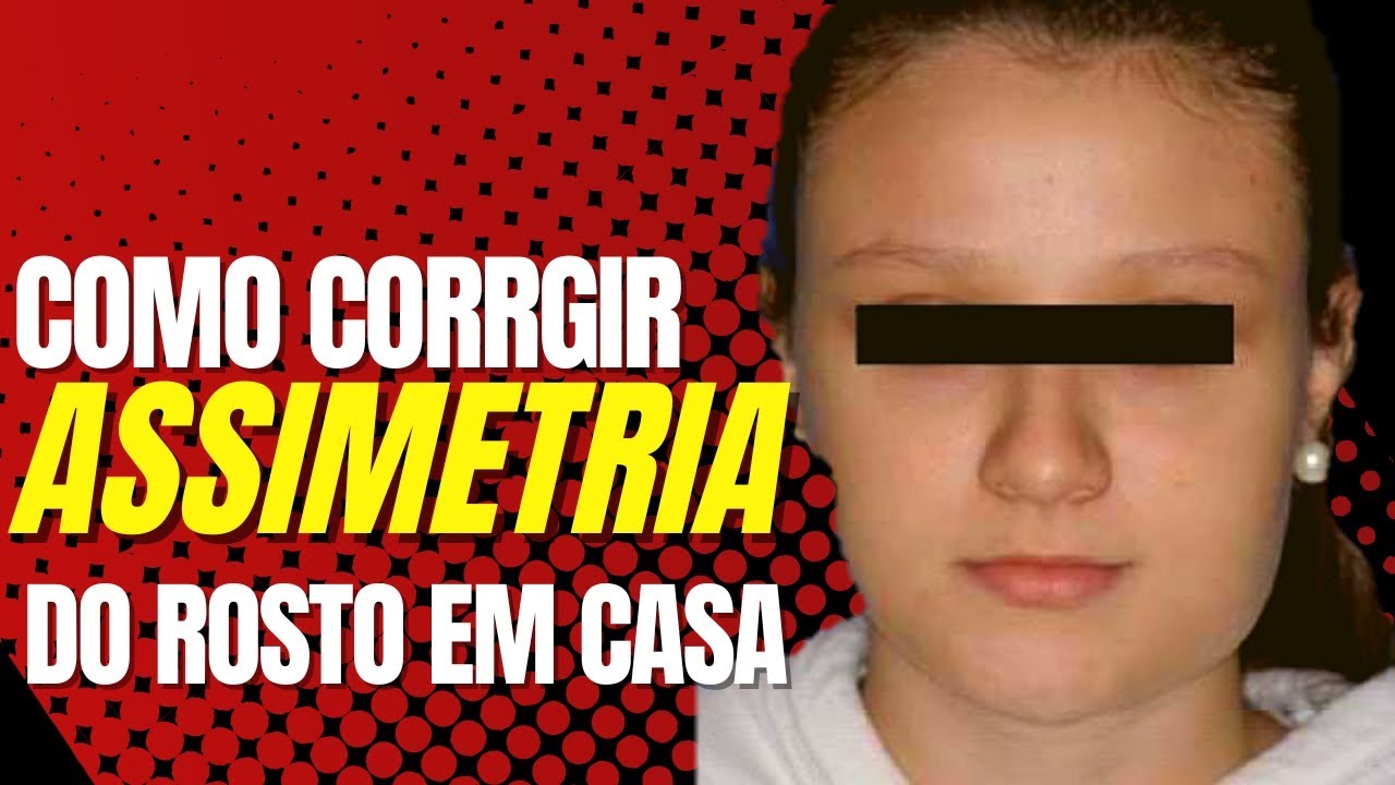 Assimetria do rosto - Rosto Inchado. #assimetria #rosto #comomelhorar