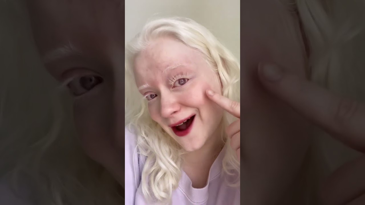 Trying White Fake Lashes with my Albinism #shorts