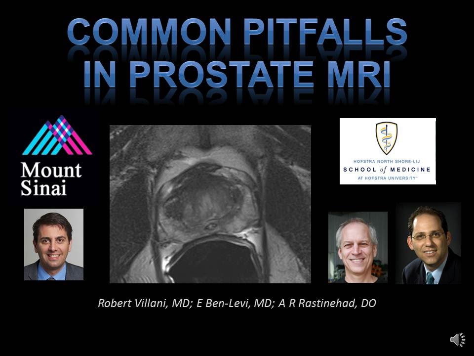 8. Prostate MRI: Common Imaging Pitfalls