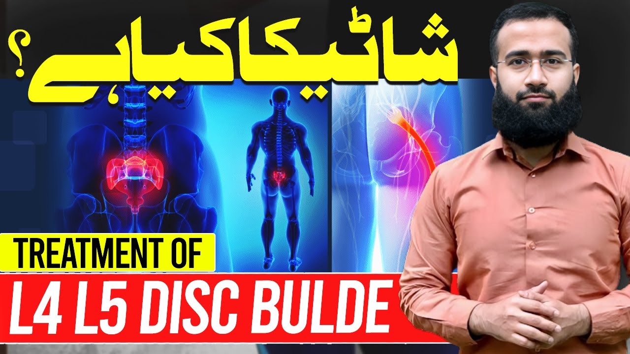 What is Sciatica? Treatment of L4L5 Disc Bulde or Herniation