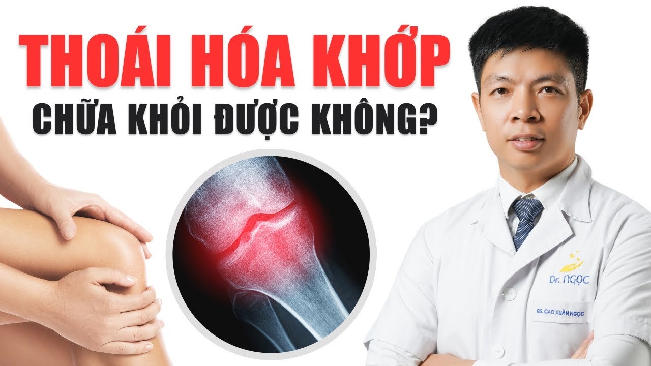 Bệnh THOÁI HÓA KHỚP có chữa được không? | Dr Ngọc