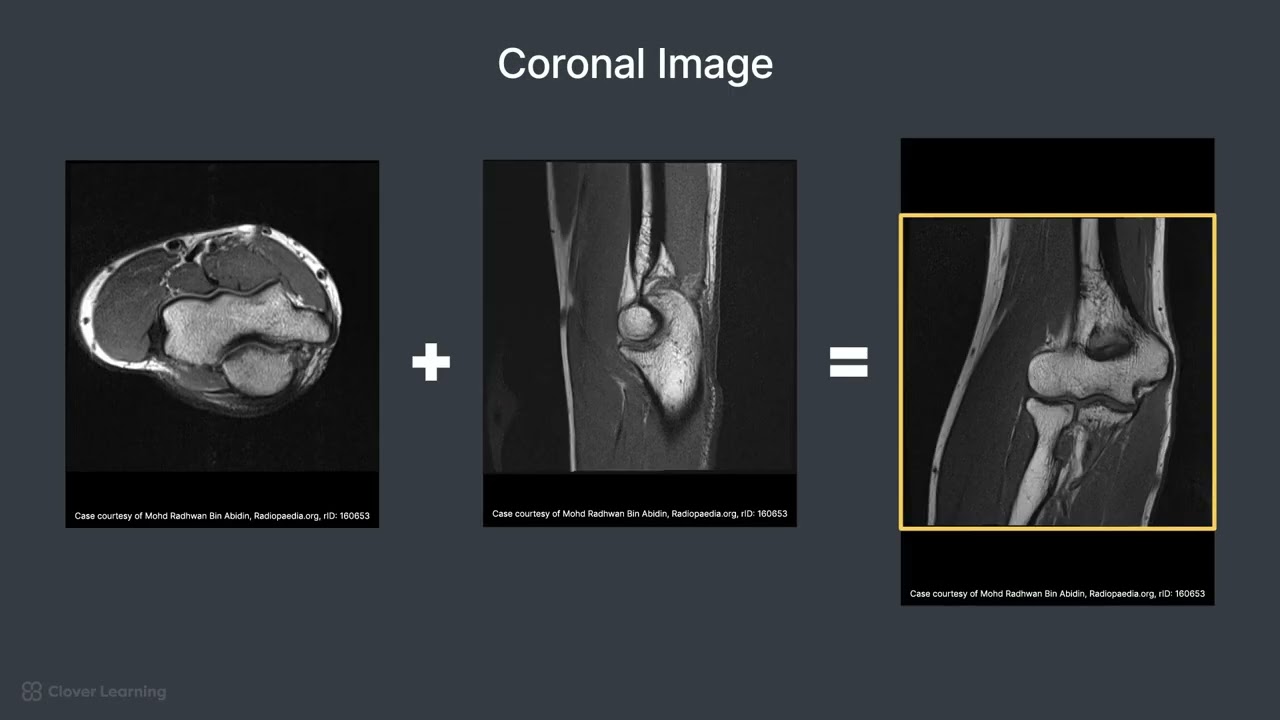 Patient Positioning and Protocol for an Elbow MRI