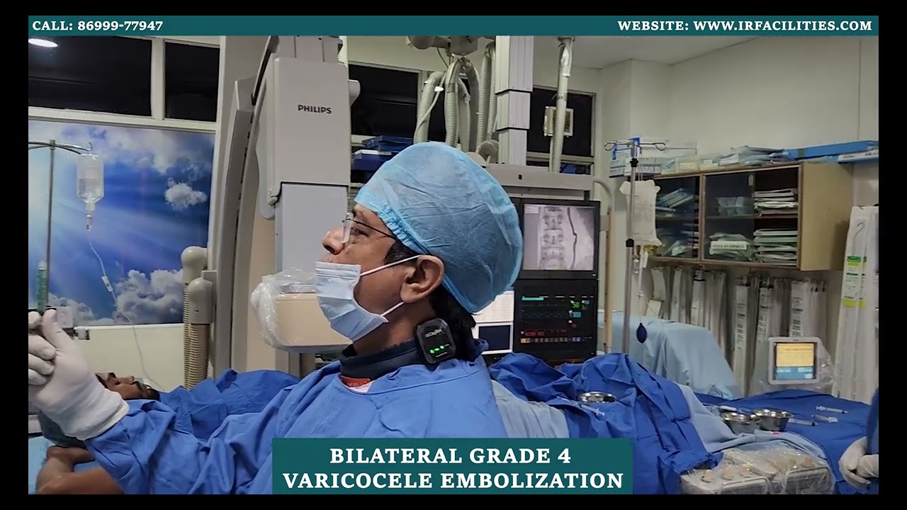Bilateral Grade 4 Varicocele Embolization by Dr. Sandeep Sharma | IRFACILITIES
