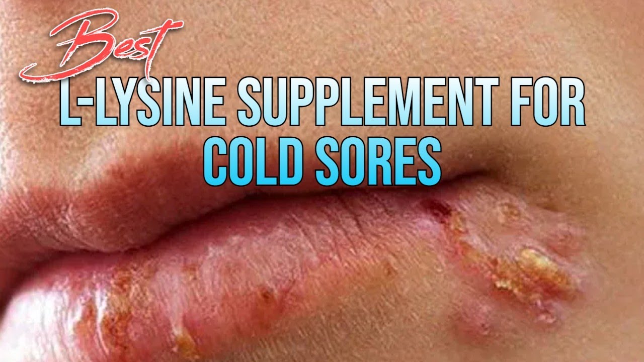The Best 03 L-Lysine Supplements For  Cold Sores Treatment uses and More.