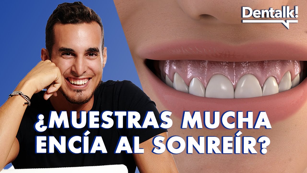 ¿MUESTRAS mucha ENCÍA al SONREÍR? -  SOLUCIÓN y causas de la SONRISA GINGIVAL | Dentalk! ©