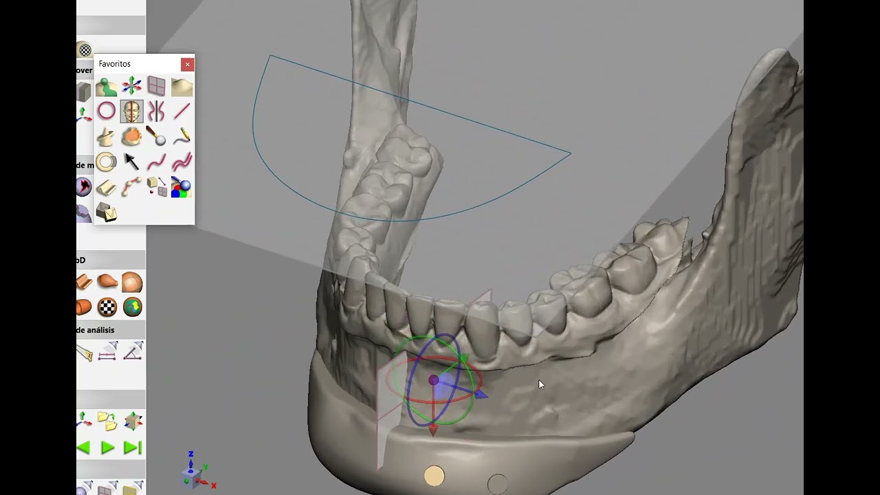 Geomagic Freeform - Designing a Custom Chin Implant