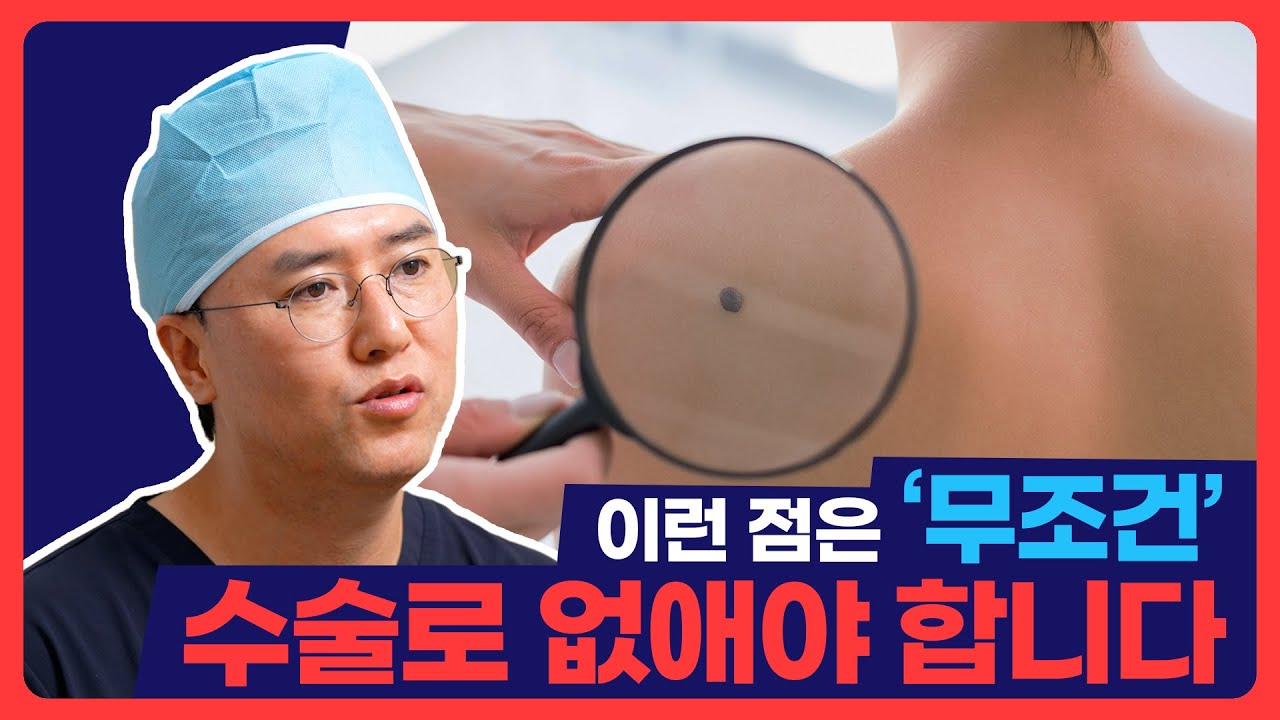 점 제거, 수술로 해야 하는 경우 따로 있습니다! #광주톱스타성형외과 #점제거