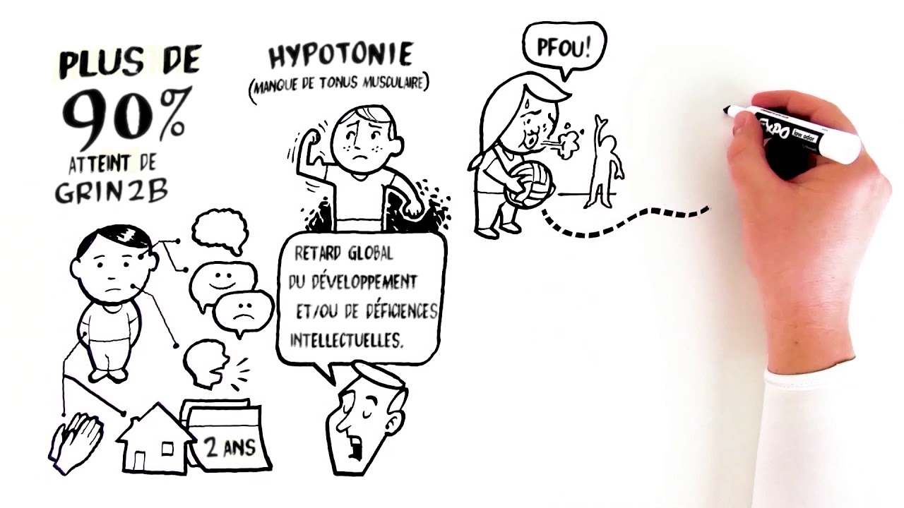 Quels sont les sympt&ocirc;mes courants des troubles neuro-d&eacute;veloppementaux li&eacute;s &agrave; GRIN2B?