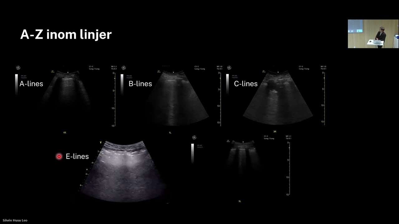 Utbildningsdag 26/2 - POCUS Lungor
