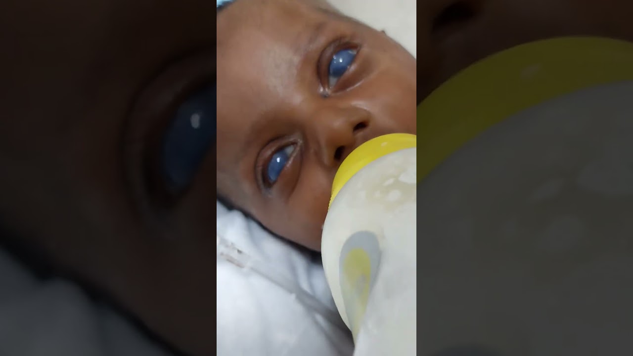 Born Blind baby #newbornbaby #cute #positivebirth #baby #adorably #newborn #nicu #nicujourney